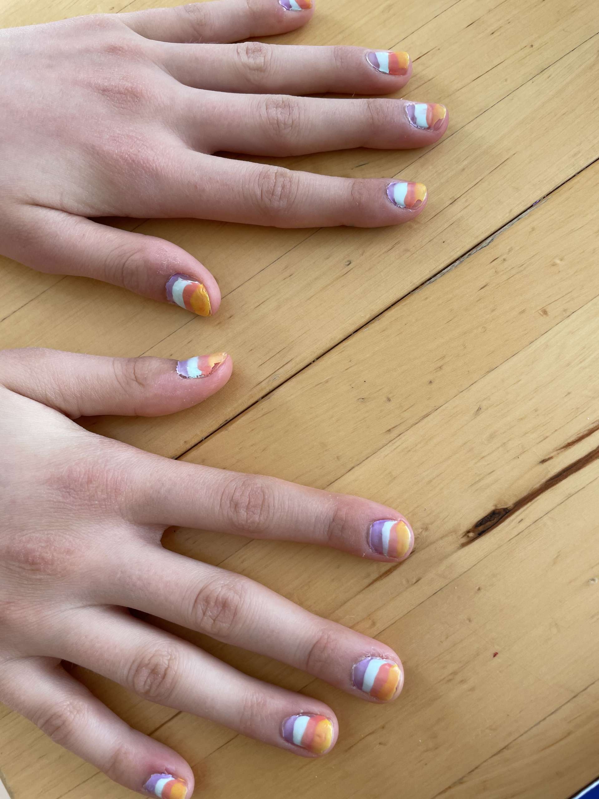 Fingernägel Brüchige Fingernägel wieder fest